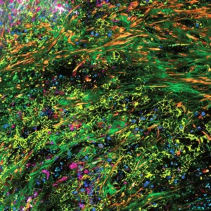 SpectraPlex-para-STELLARIS-microscopio-de-multiplexacao